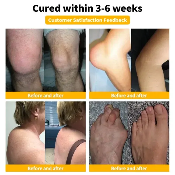 πππ Poison πππ―ππ§πππ ππ¨π’π§π ππ§π ππ¨π§π ππ‘ππ«ππ©π² ππ«πππ¦