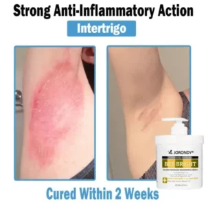 Bee Bright Multi-Symptom Skin Treatment Cream