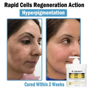 Bee Bright Multi-Symptom Skin Treatment Cream