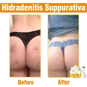 Bee Venom Comprehensive Cream