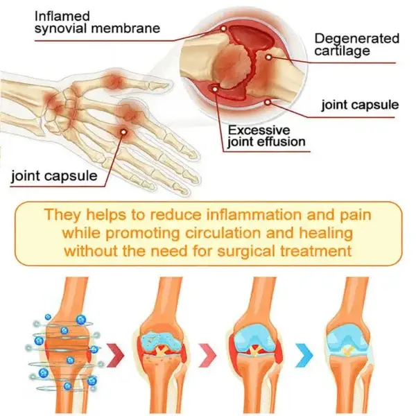 Bee Venom Pain-Relief Bone Healing Spray