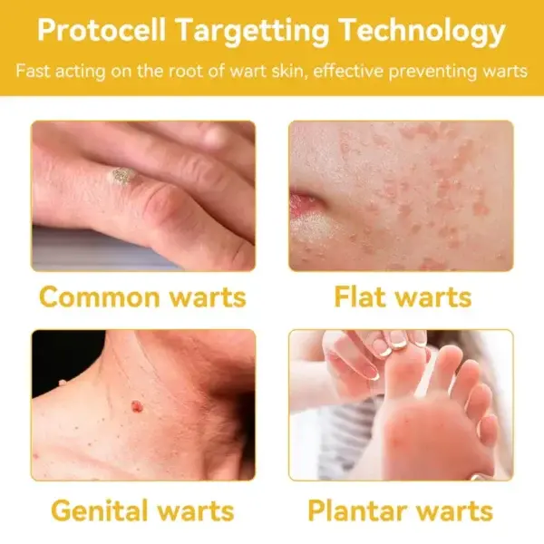 Bee Venom Skin Treatment Cream