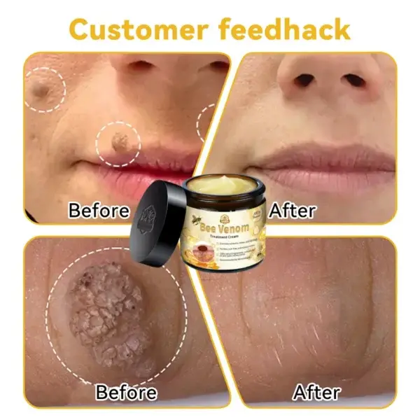 Bee Venom Skin Treatment Cream