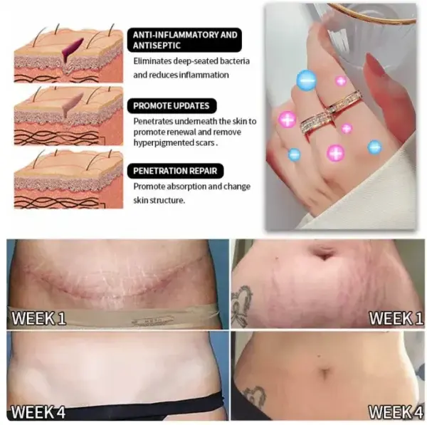 Lymphatic Magnetic Therapy Diamond Ring