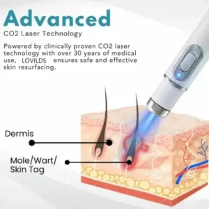 Non-Invasive Mole and Wart Removal Laser Pen