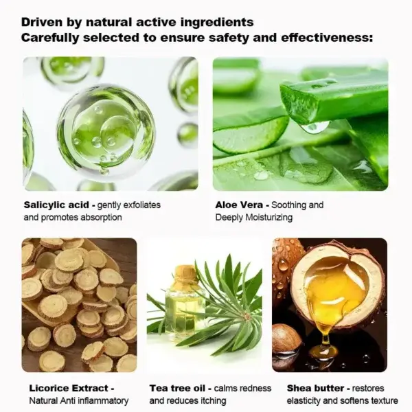 Psoriasis Cure Cream