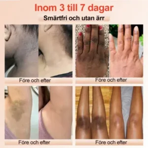 Purifying Peeling Gel