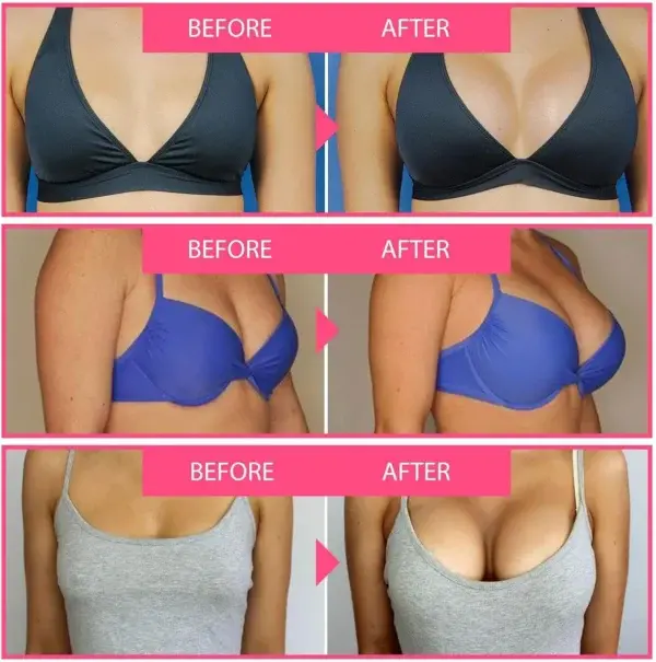 Royal Jelly Moisturizing Lifting Cream