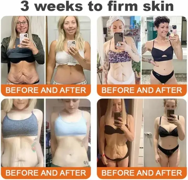 Royal Jelly Moisturizing Lifting Cream