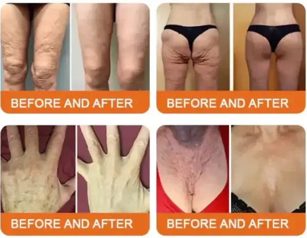 Royal Jelly Moisturizing Lifting Cream