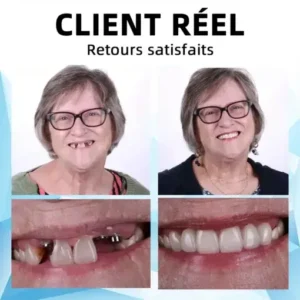 Silicone Reline Denture Set