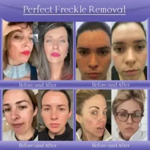 Skin Firming & Anti-Wrinkle Cream