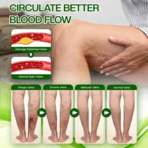 SwellRelief Horse Chestnut Edema Cream