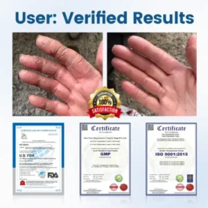 Timilk® AngioVita Diabetic Care Spray