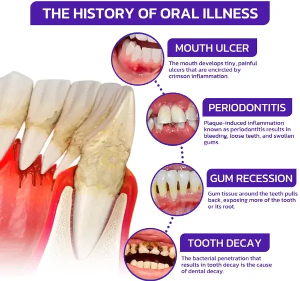 VioGloss Bienengift-Zahntherapie Oral Power