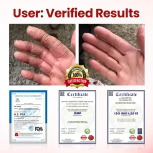 VitaGluco Diabetic Care Cream