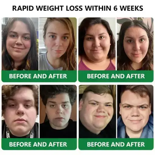 ๐ต๐๐๐ ๐ด๐๐๐๐๐๐๐๐
๐๐ ๐ท๐๐๐๐ - Image 4