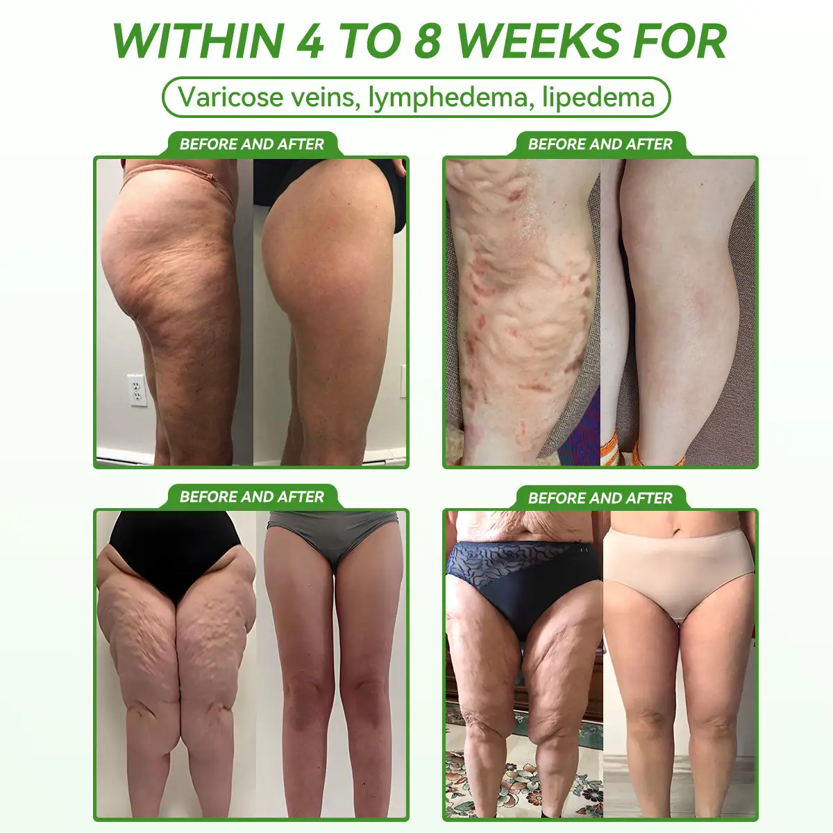 ๐๐พ๐ญ๐๐๐ผ๐ฅ๐ข๐ ๐๐๐ฅ๐๐ง๐๐ฒ ๐ข๐ซ๐๐ฅ ๐๐ฆ๐ฉ๐ผ๐ฎ๐ฅ๐ฒ - Image 5