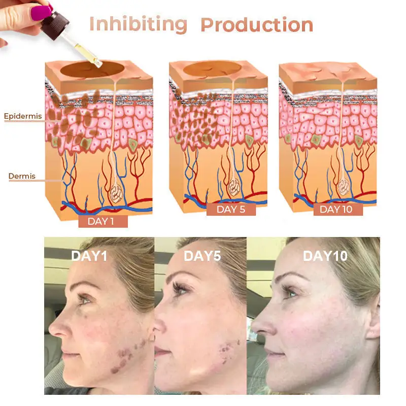 Fast Dark Spot Remover - Image 15