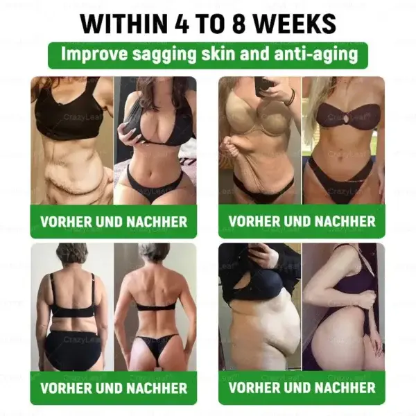 6-๐๐-1 ๐ฏ๐๐๐๐๐ ๐บ๐๐๐๐๐๐๐ ๐ฎ๐๐บ๐
๐๐ข๐ช๐ฎ๐ข๐