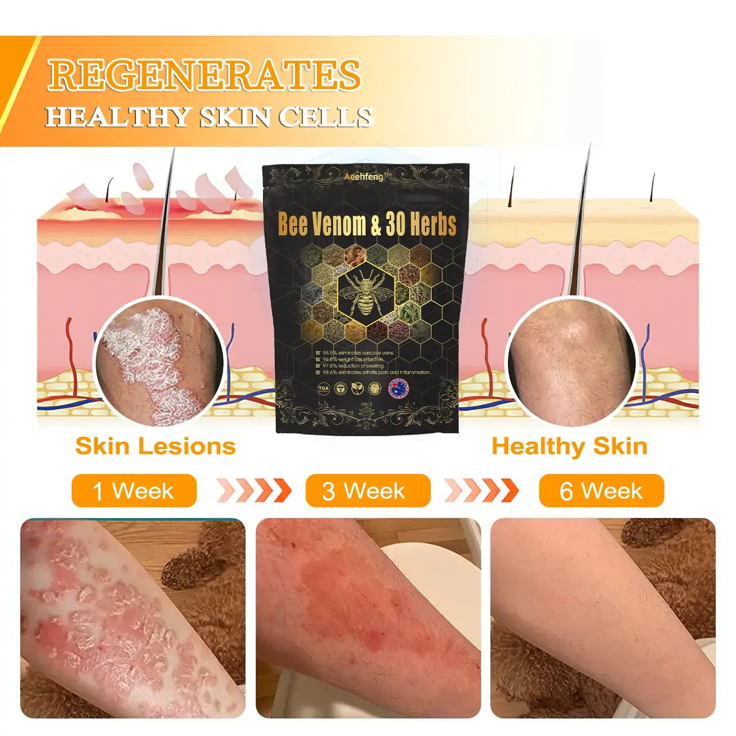 ๐๐๐ ๐๐๐ง๐จ๐ฆ & ๐๐-๐๐๐ซ๐ ๐๐๐ญ๐จ๐ฑ ๐
๐จ๐จ๐ญ ๐๐จ๐๐ค ๐๐๐๐๐ฌ ๐๐จ๐ซ ๐๐จ๐๐ฒ ๐๐๐ฎ๐ฅ๐ฉ๐ญ๐ข๐ง๐ - Image 11