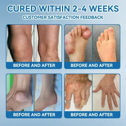 ๐๐๐-๐๐๐ ๐๐จ๐ข๐ง๐ญ ๐๐๐๐ฅ๐ข๐ง๐ ๐๐ซ๐๐๐ฆ - Image 7