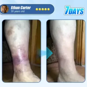 Alternative view of Diabetic Skin Revolution – 6-IN-1 Clinical Solution Black Fridey