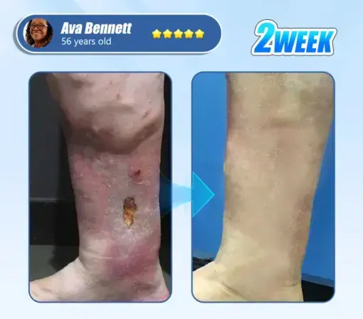 Diabetic Skin Revolution – 6-IN-1 Clinical Solution Black Fridey - Image 4