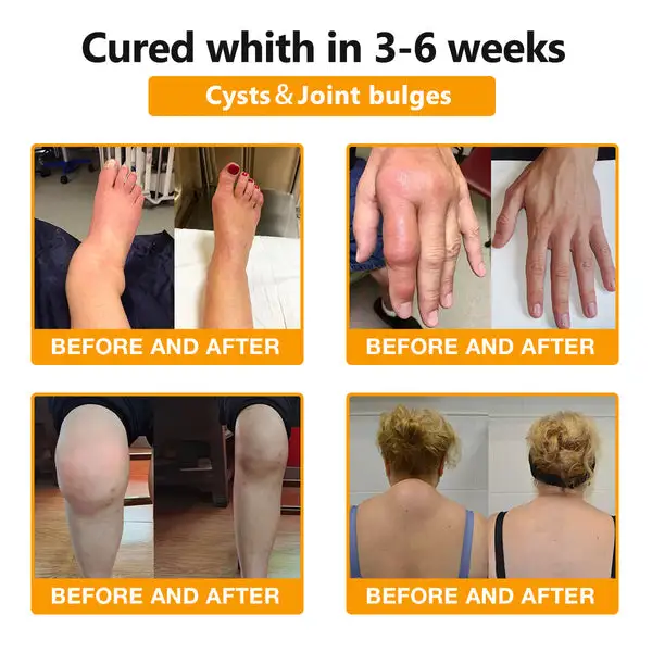 Bee Venom & Turmeric Arthritis Therapy Cream - Image 4