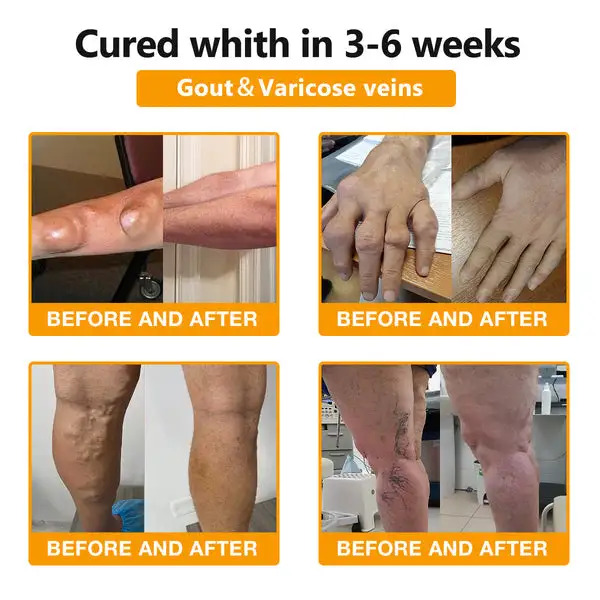 Bee Venom & Turmeric Arthritis Therapy Cream - Image 6