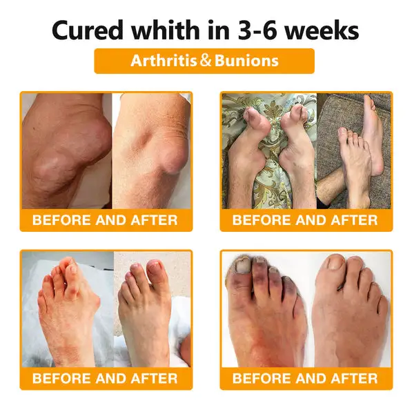 Bee Venom & Turmeric Arthritis Therapy Cream - Image 8