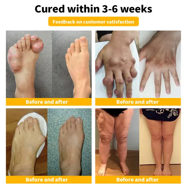 Bee Venom & Turmeric Arthritis Therapy Cream - Image 9