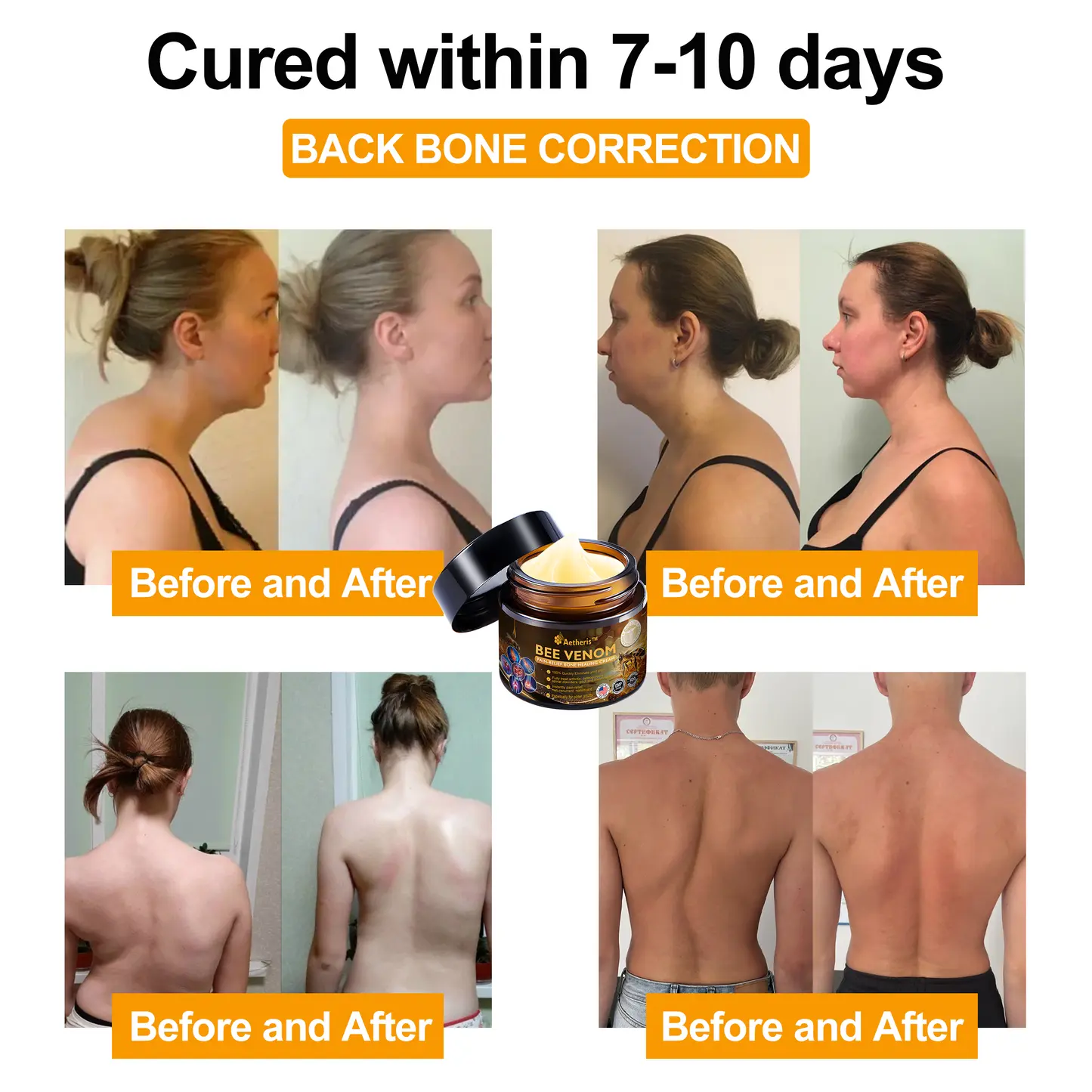 Bee Venom Arthritis Therapy Cream - Image 3