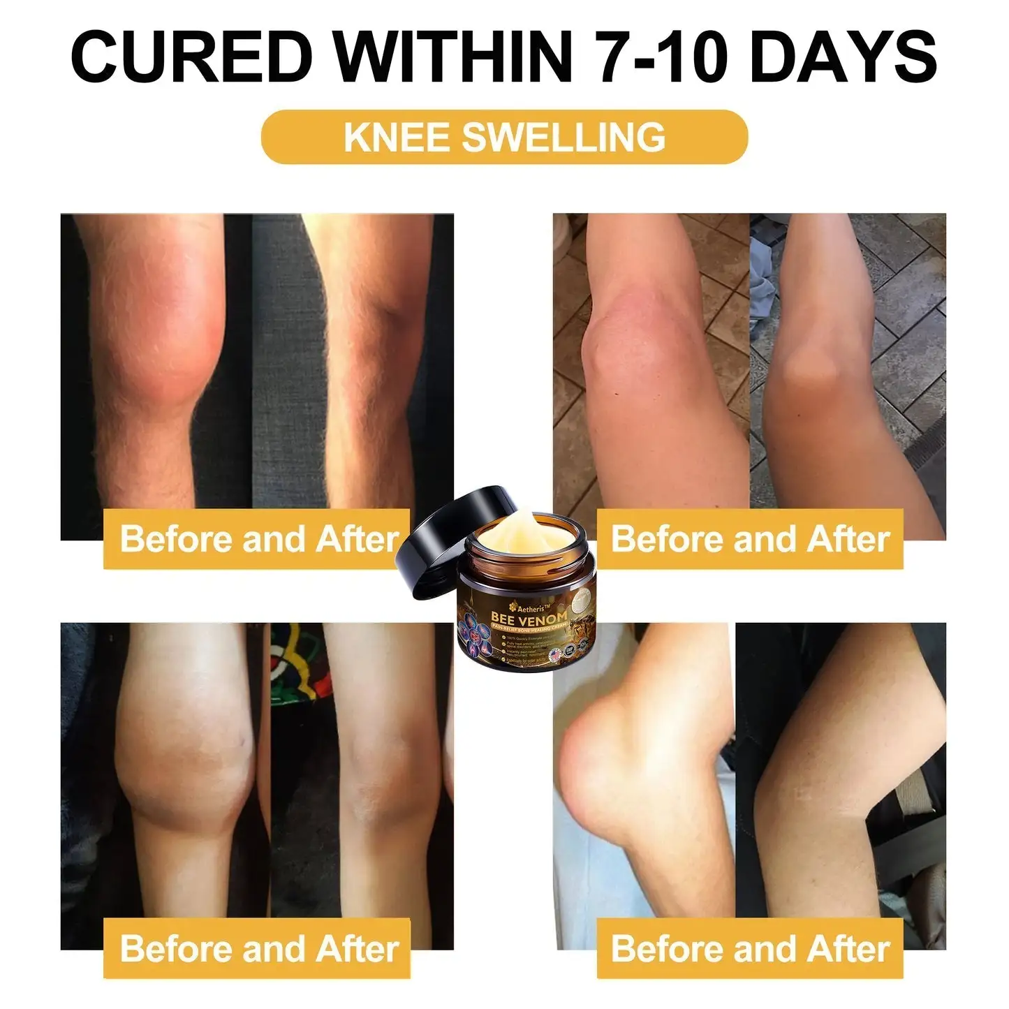 Bee Venom Arthritis Therapy Cream - Image 4