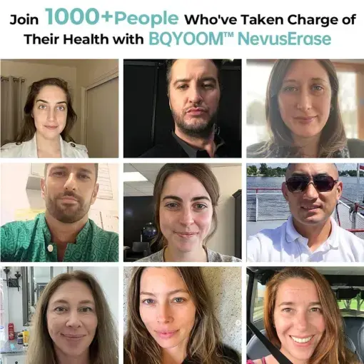 Nevus Erase Instant Mole & Spot Removal Gel - Image 2