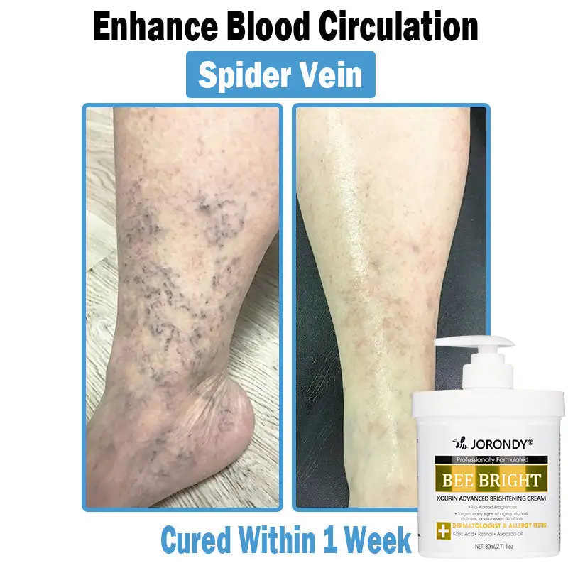 Bee Bright Multi-Symptom Skin Treatment Cream - Image 11