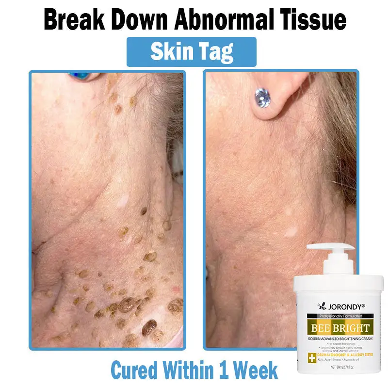 Bee Bright Multi-Symptom Skin Treatment Cream - Image 6