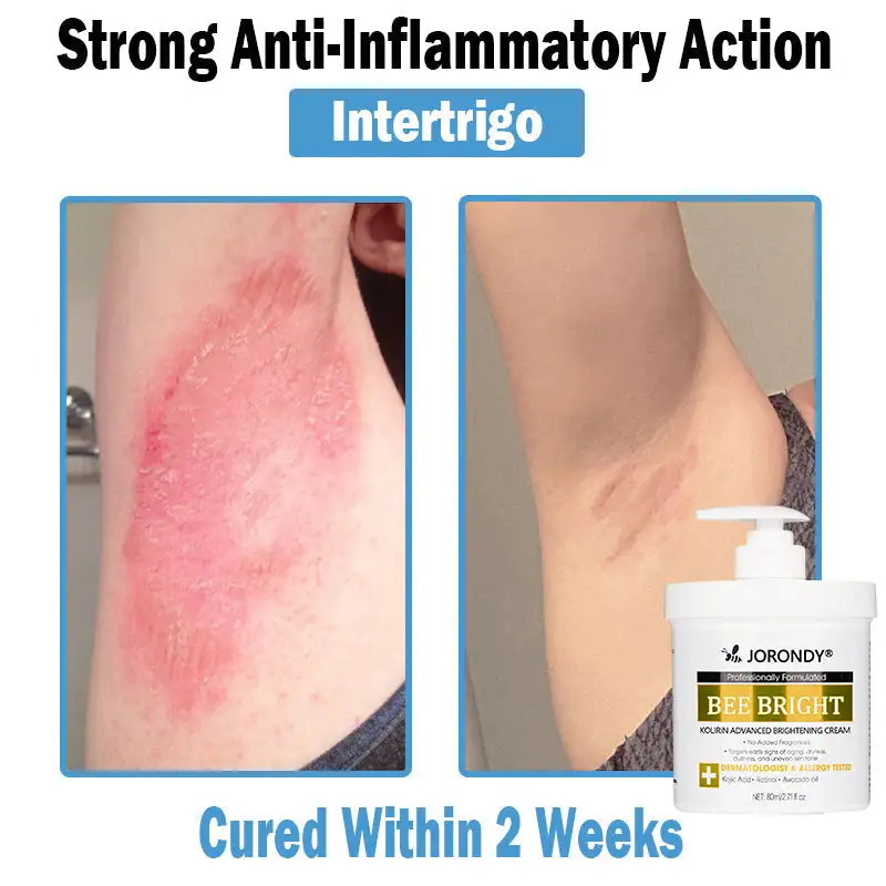 Bee Bright Multi-Symptom Skin Treatment Cream - Image 7