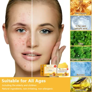 Alternative view of Bee Venom Wart & Moles Removal Cream