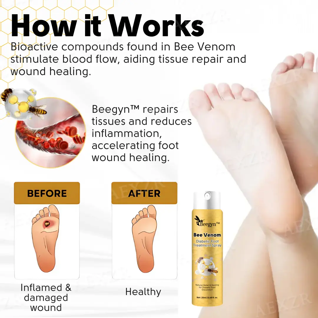 Bee Venom Diabetic Foot Treatment Spray - Image 5