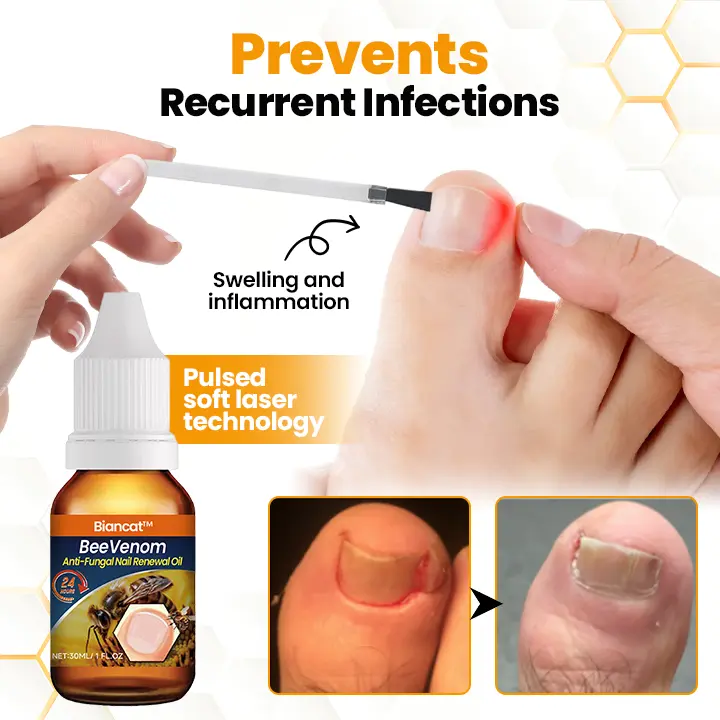BeeVenom Anti-Fungal Nail Renewal Oil - Image 4