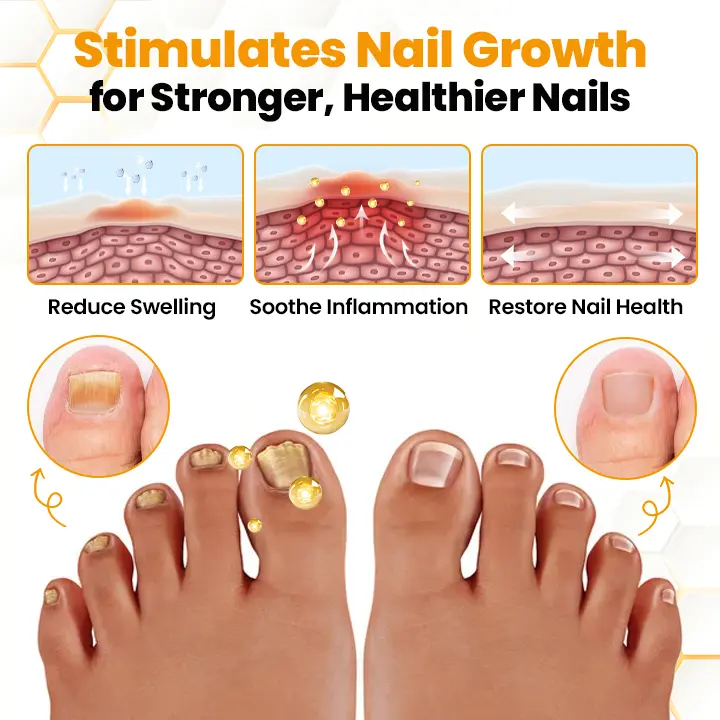 BeeVenom Anti-Fungal Nail Renewal Oil - Image 5