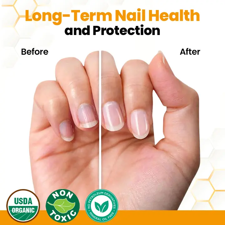 BeeVenom Anti-Fungal Nail Renewal Oil - Image 7