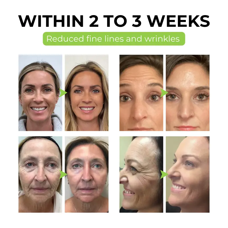 FirmaDerm Collagen Peptide Cream - Image 8