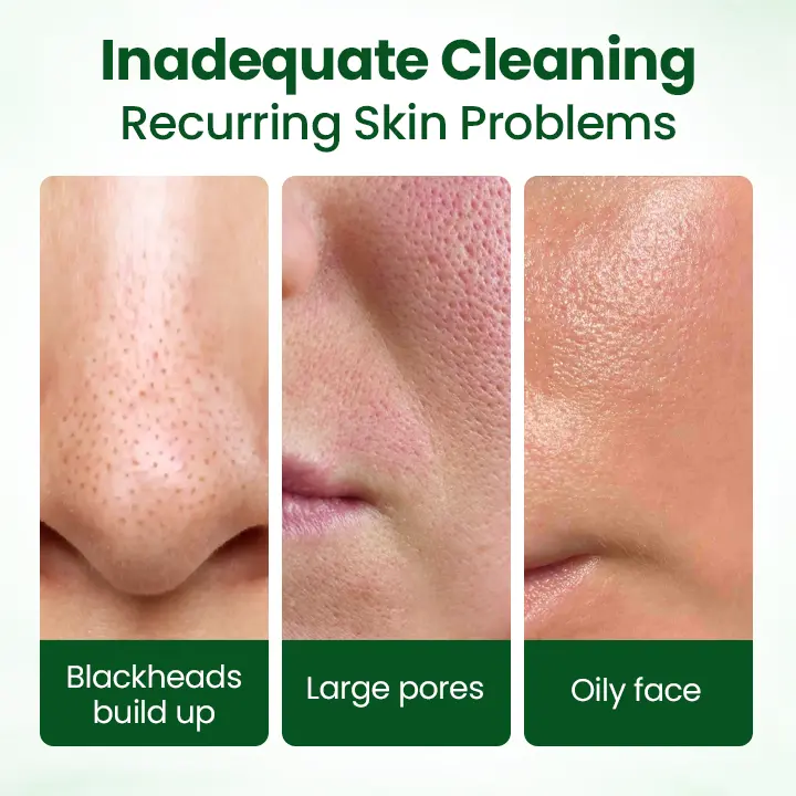 PoreMelt Avocado Acid Mask - Image 4