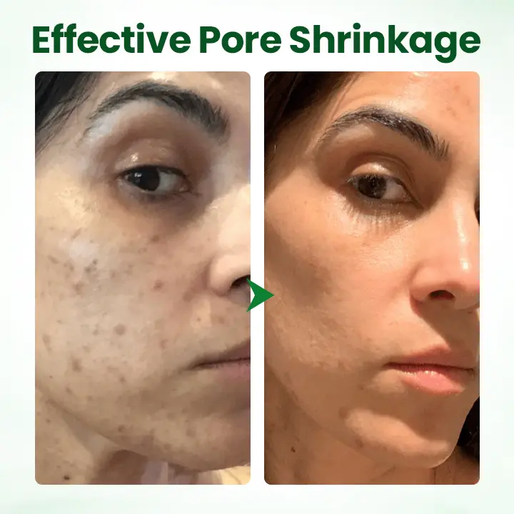 PoreMelt Avocado Acid Mask - Image 6