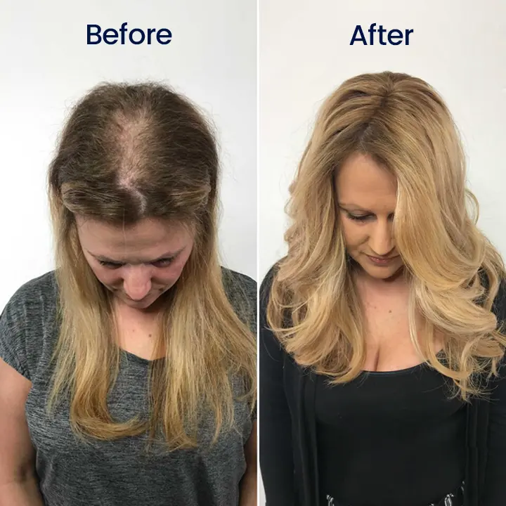 Maximum Strength 5% Minoxidil Fast-Action Hair Growth Serum - Image 10