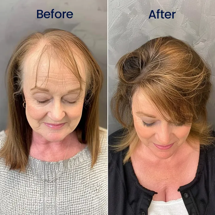 Maximum Strength 5% Minoxidil Fast-Action Hair Growth Serum - Image 9