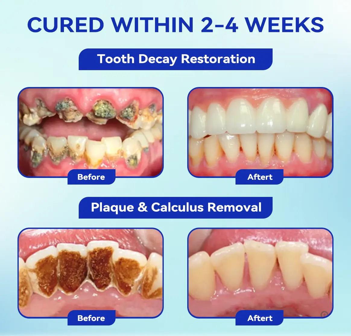 Focus Smile Bee Venom Treatment Oral Powder - Image 4