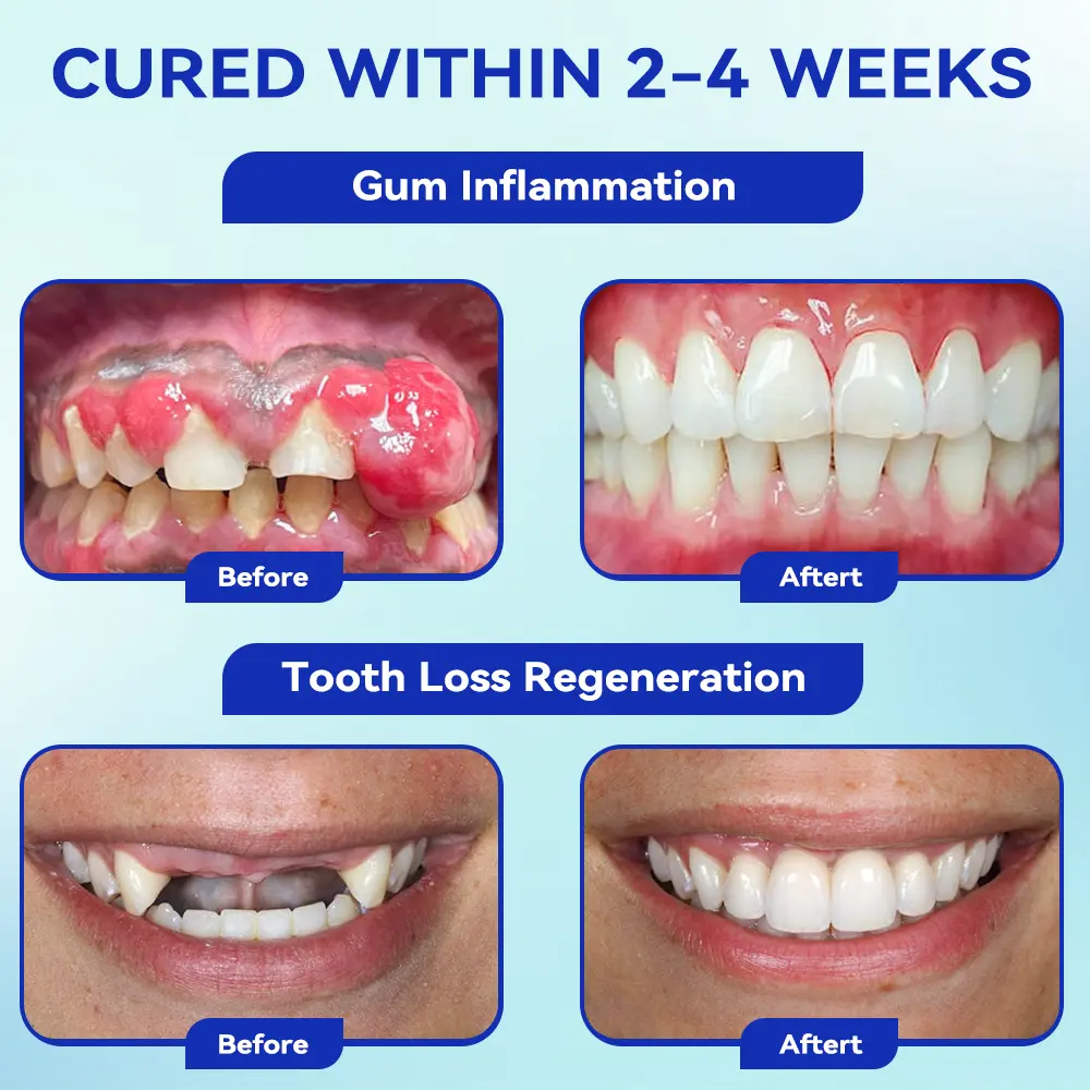 Focus Smile Bee Venom Treatment Oral Powder - Image 5